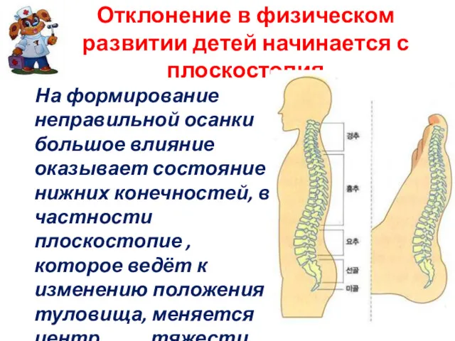 Отклонение в физическом развитии детей начинается с плоскостопия На формирование