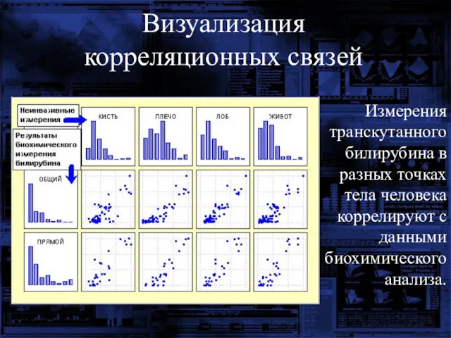 Измерения транскутанного билирубина в разных точках тела человека коррелируют с данными биохимического анализа. Визуализация корреляционных связей