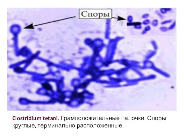 Clostridium tetani. Грамположительные палочки. Споры круглые, терминально расположенные.