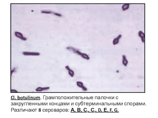 Cl. botulinum. Грамположительные палочки с закругленными концами и субтерминальными спорами.