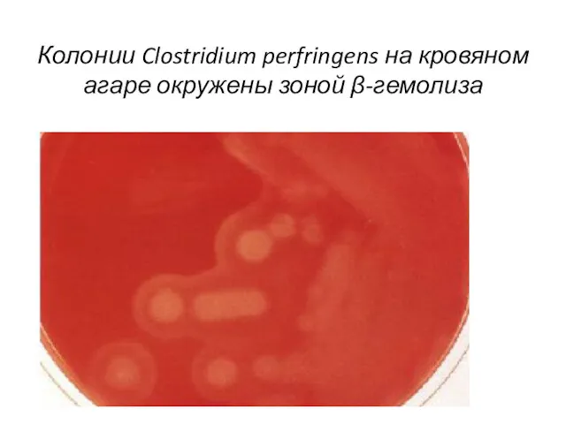 Колонии Clostridium perfringens на кровяном агаре окружены зоной β-гемолиза
