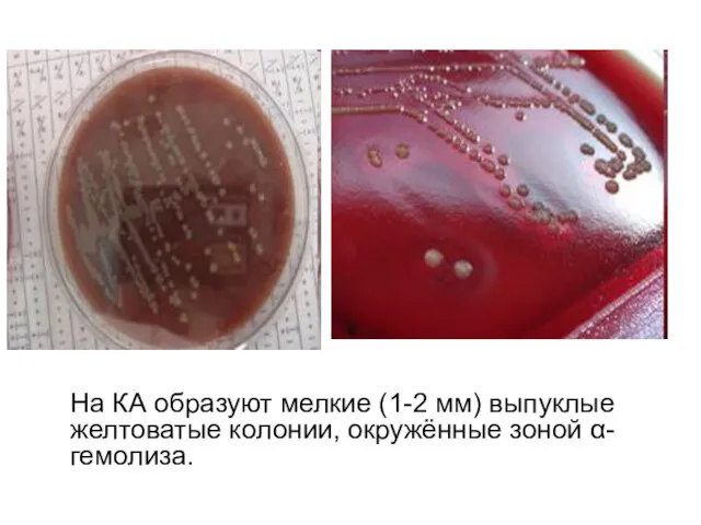 На КА образуют мелкие (1-2 мм) выпуклые желтоватые колонии, окружённые зоной α-гемолиза.