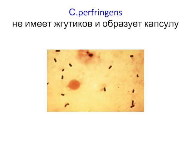 С.perfringens не имеет жгутиков и образует капсулу