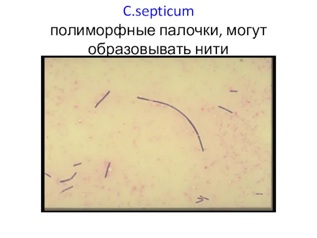 C.septicum полиморфные палочки, могут образовывать нити