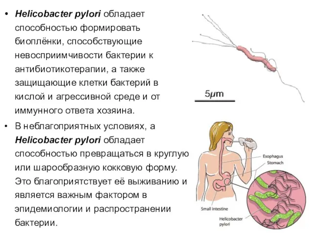 Helicobacter pylori обладает способностью формировать биоплёнки, способствующие невосприимчивости бактерии к