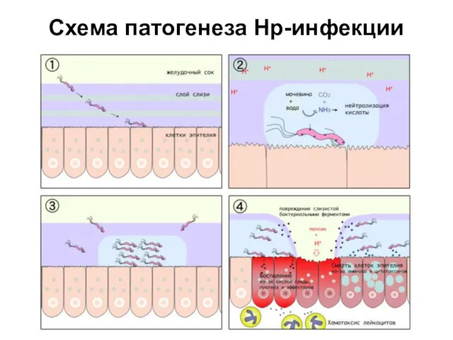 Схема патогенеза Нр-инфекции