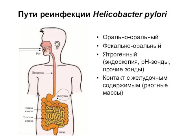 Пути реинфекции Helicobacter pylori Орально-оральный Фекально-оральный Ятрогенный (эндоскопия, pH-зонды, прочие