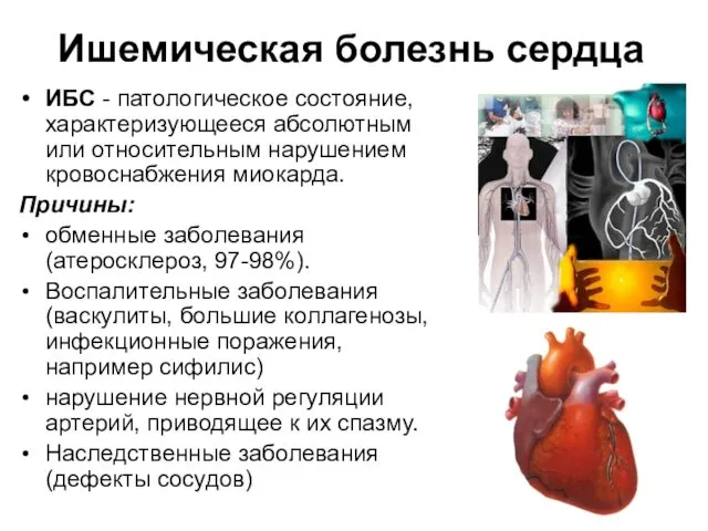 Ишемическая болезнь сердца ИБС - патологическое состояние, характеризующееся абсолютным или