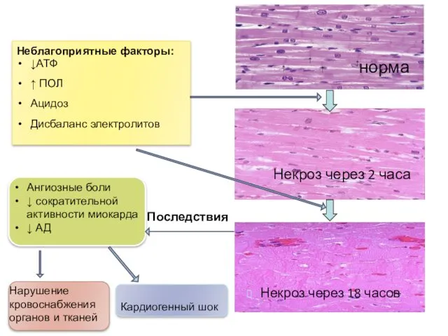 норма Некроз через 2 часа Некроз через 18 часов Неблагоприятные