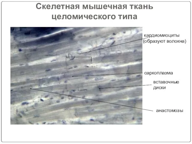 кардиомиоциты (образуют волокна) саркоплазма вставочные диски анастомозы Скелетная мышечная ткань целомического типа