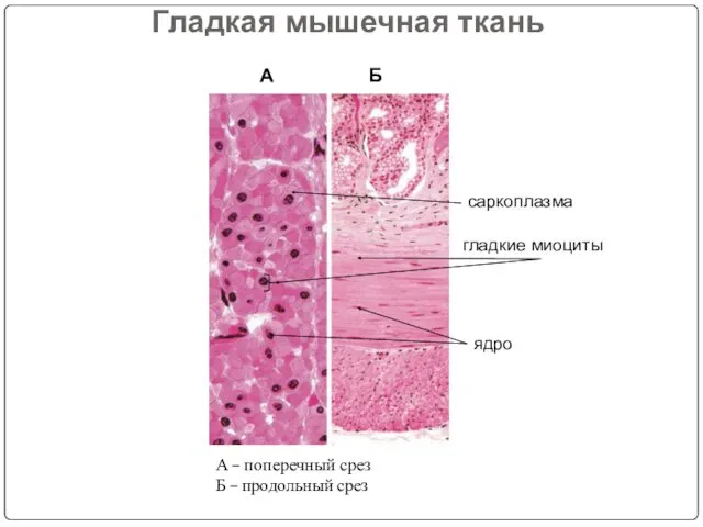 Гладкая мышечная ткань А Б А – поперечный срез Б