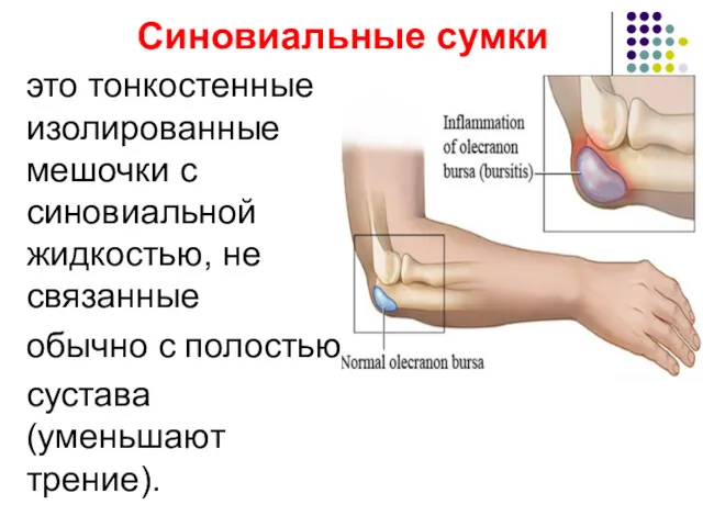 Синовиальные сумки это тонкостенные изолированные мешочки с синовиальной жидкостью, не