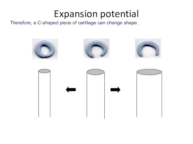 Therefore, a C-shaped piece of cartilage can change shape. Expansion potential