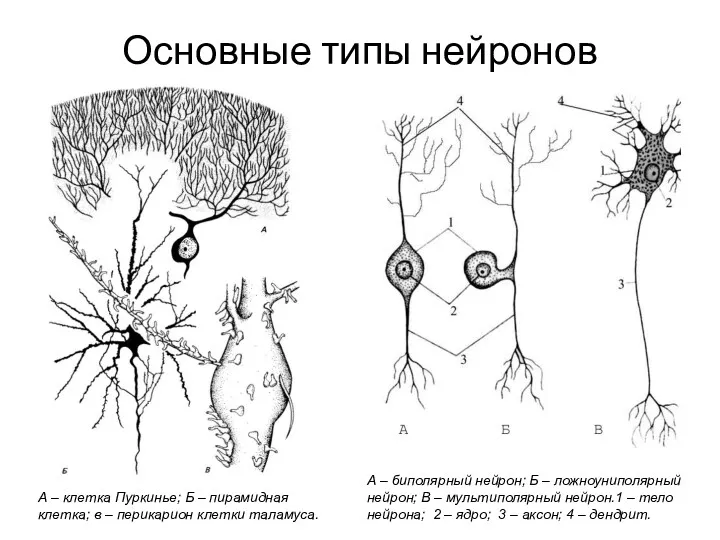 А – биполярный нейрон; Б – ложноуниполярный нейрон; В –