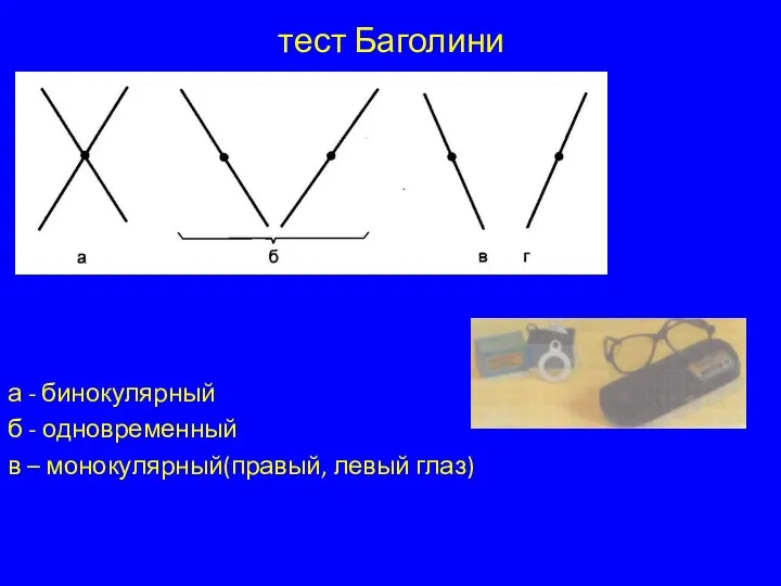 тест Баголини а - бинокулярный б - одновременный в – монокулярный(правый, левый глаз)
