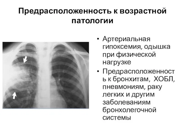 Предрасположенность к возрастной патологии Артериальная гипоксемия, одышка при физической нагрузке