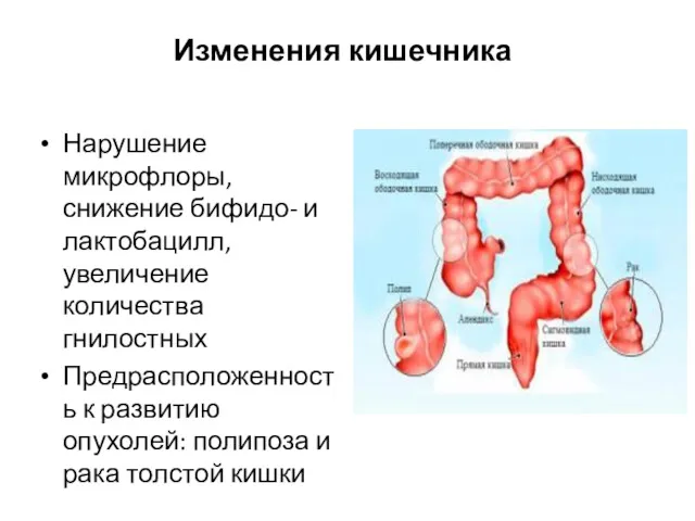 Изменения кишечника Нарушение микрофлоры, снижение бифидо- и лактобацилл, увеличение количества