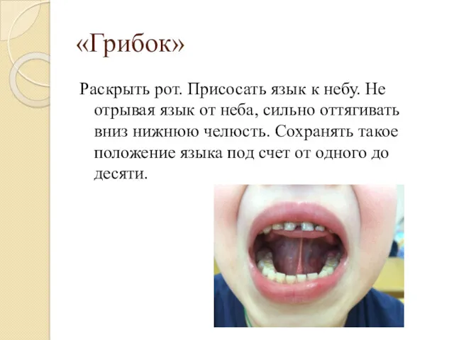 «Грибок» Раскрыть рот. Присосать язык к небу. Не отрывая язык от неба, сильно