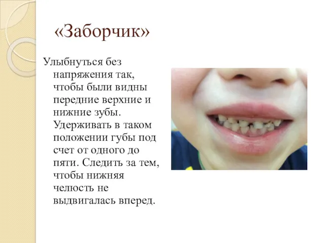 «Заборчик» Улыбнуться без напряжения так, чтобы были видны передние верхние и нижние зубы.