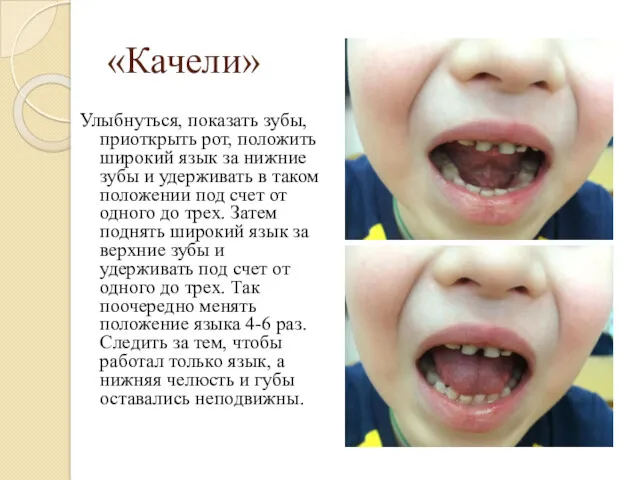 «Качели» Улыбнуться, показать зубы, приоткрыть рот, положить широкий язык за нижние зубы и