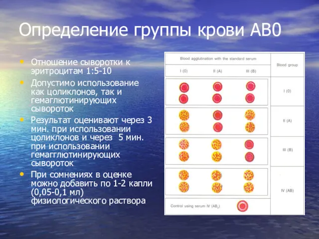 Определение группы крови АВ0 Отношение сыворотки к эритроцитам 1:5-10 Допустимо