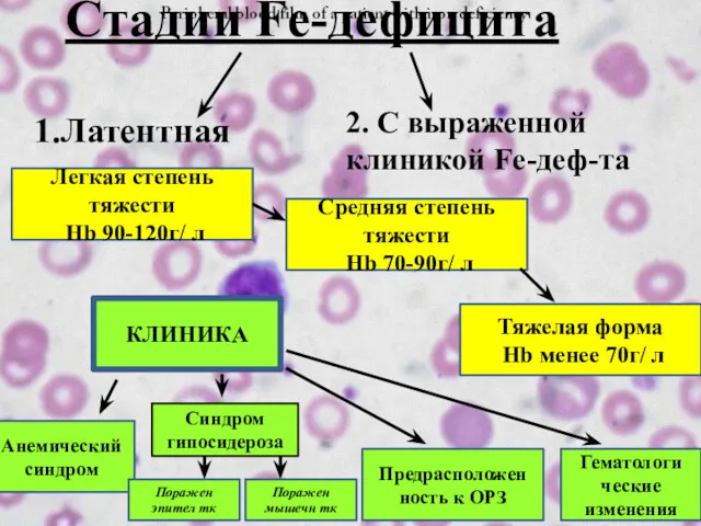 Стадии Fe-дефицита 1.Латентная 2. С выраженной клиникой Fe-деф-та Легкая степень