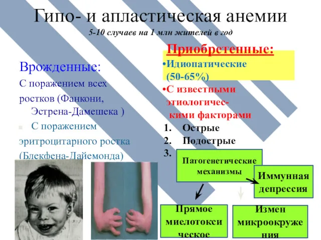 Гипо- и апластическая анемии 5-10 случаев на 1 млн жителей