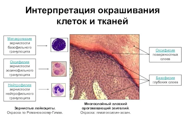 Интерпретация окрашивания клеток и тканей Многослойный плоский ороговевающий эпителий. Окраска: гематоксилин-эозин. Оксифилия поверхностных