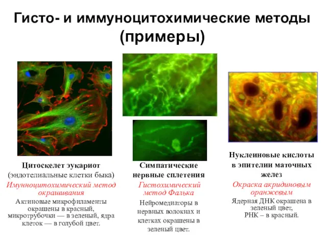 Гисто- и иммуноцитохимические методы (примеры) Цитоскелет эукариот (эндотелиальные клетки быка) Имунноцитохимический метод окрашивания