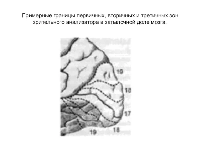 Примерные границы первичных, вторичных и третичных зон зрительного анализатора в затылочной доле мозга.