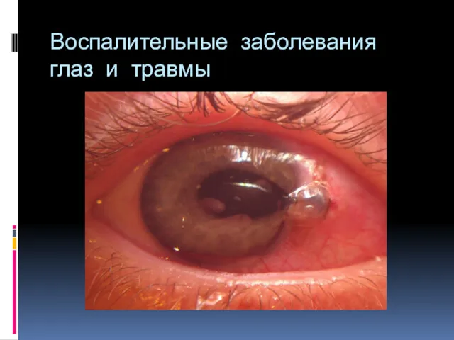 Воспалительные заболевания глаз и травмы