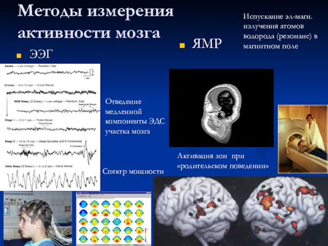 Методы измерения активности мозга ЭЭГ ЯМР Отведение медленной компоненты ЭДС