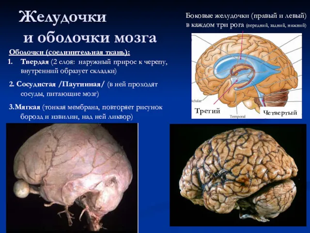 Желудочки и оболочки мозга Боковые желудочки (правый и левый) в