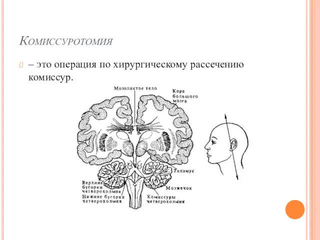 Комиссуротомия – это операция по хирургическому рассечению комиссур.