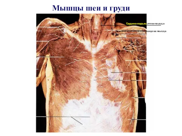 Мышцы шеи и груди Грудино-ключично-сосцевидная мышца ________________________ Грудино-подъязычная мышца