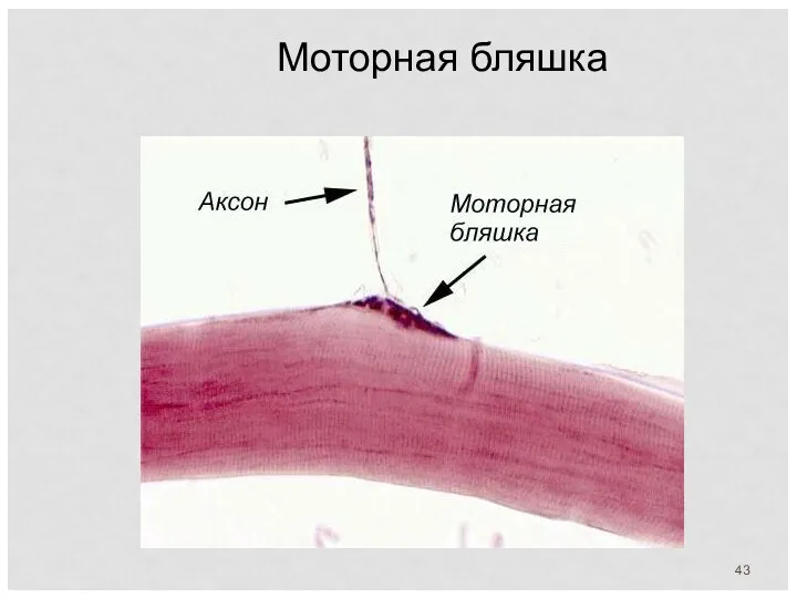 Моторная бляшка