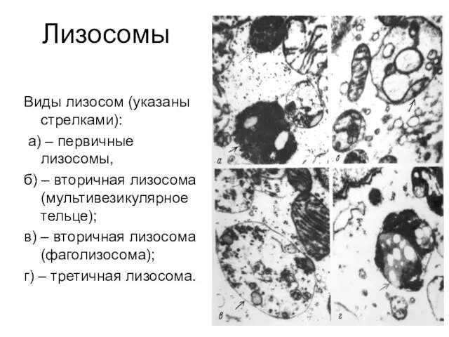 Лизосомы Виды лизосом (указаны стрелками): а) – первичные лизосомы, б)