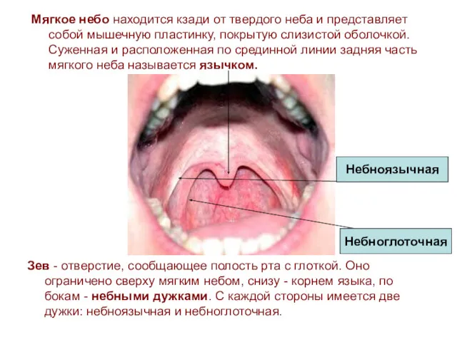 Зев - отверстие, сообщающее полость рта с глоткой. Оно ограничено сверху мягким небом,