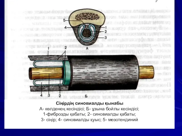 Сіңірдің синовиалды қынабы А- көлденең кесіндісі; Б- ұзына бойлы кесіндісі; 1-фиброзды қабаты; 2-