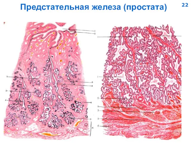 Предстательная железа (простата) 22