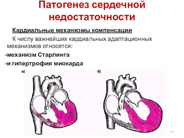 Патогенез сердечной недостаточности Кардиальные механизмы компенсации К числу важнейших кардиальных