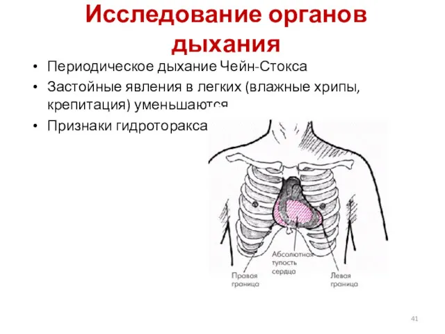 Исследование органов дыхания Периодическое дыхание Чейн-Стокса Застойные явления в легких (влажные хрипы, крепитация) уменьшаются Признаки гидроторакса