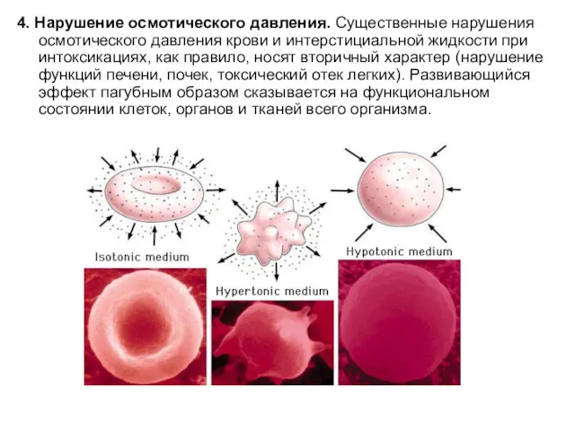 4. Нарушение осмотического давления. Существенные нарушения осмотического давления крови и интерстициальной жидкости при