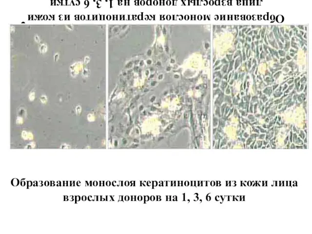 Образование монослоя кератиноцитов из кожи лица взрослых доноров на 1, 3, 6 сутки