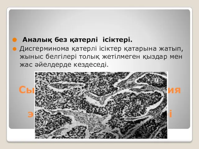 Сыртқы және ішкі секреция бездері мен жамылғы эпителий қатерлі ісіктері