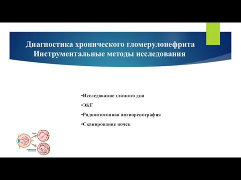 Диагностика хронического гломерулонефрита Инструментальные методы исследования Исследование глазного дна ЭКГ Радиоизотопная ангиоренография Сканирование почек