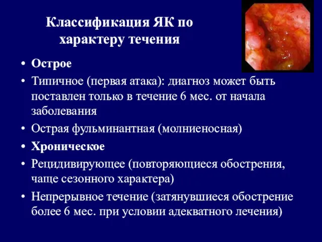 Классификация ЯК по характеру течения Острое Типичное (первая атака): диагноз