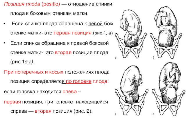 Позиция плода (positio) — отношение спинки плода к боковым стенкам