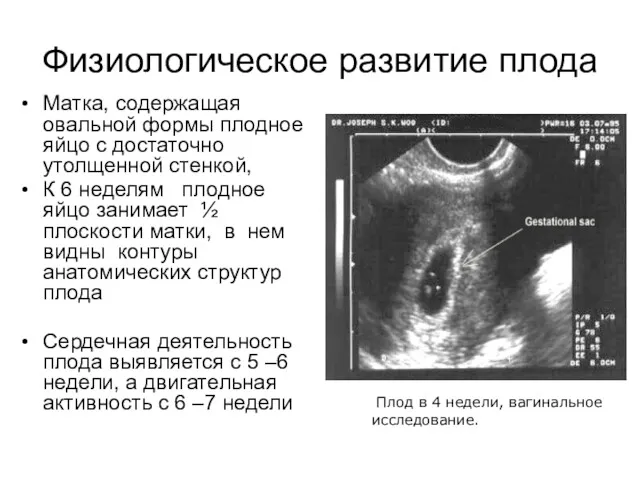 Физиологическое развитие плода Матка, содержащая овальной формы плодное яйцо с