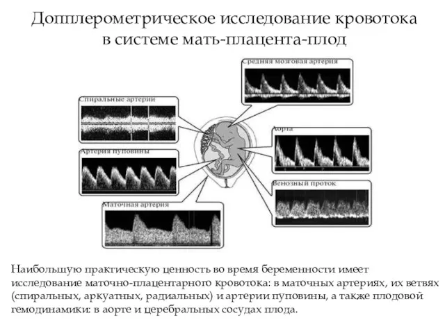 Допплерометрическое исследование кровотока в системе мать-плацента-плод Наибольшую практическую ценность во